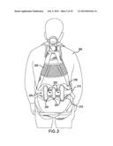 Lumbar Wear-Pad diagram and image