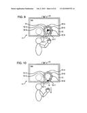 IMAGE PROCESSING APPARATUS AND METHOD, AND PROGRAM THEREFOR diagram and image