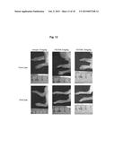 IL-1beta NEUTRALIZING HUMAN MONOCLONAL ANTIBODIES diagram and image