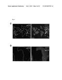 MAMMALIAN HOMOLOGUES OF FLOWER, THEIR USE IN CANCER DIAGNOSTICS,     PREVENTION AND TREATMENT diagram and image