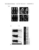 MAMMALIAN HOMOLOGUES OF FLOWER, THEIR USE IN CANCER DIAGNOSTICS,     PREVENTION AND TREATMENT diagram and image