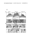 MAMMALIAN HOMOLOGUES OF FLOWER, THEIR USE IN CANCER DIAGNOSTICS,     PREVENTION AND TREATMENT diagram and image