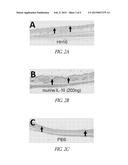 SUSTAINED RELEASE FORMULATION OF INTERLEUKIN-10 FOR WOUND TREATMENT AND     RELATED METHODS diagram and image