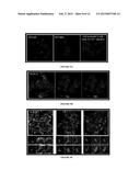 NOVEL ANTIGEN BINDING PROTEIN AND ITS USE AS ADDRESSING PRODUCT FOR THE     TREATMENT OF CANCER diagram and image