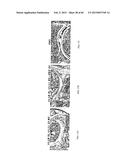 Anti-Tumor Necrosis Factor-Alpha Agents and Uses Thereof diagram and image