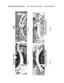 Anti-Tumor Necrosis Factor-Alpha Agents and Uses Thereof diagram and image