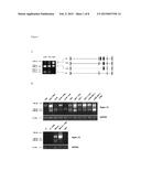 ANTI-SIGLEC-15 ANTIBODIES AND USES THEREOF diagram and image