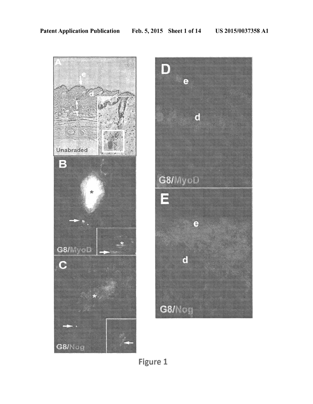 Composition and Methods for Treating Cancer - diagram, schematic, and image 02