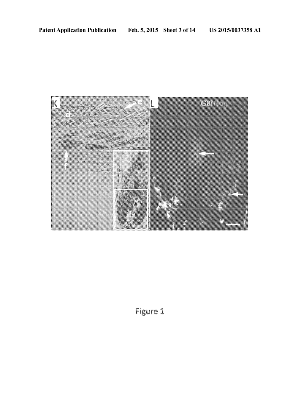 Composition and Methods for Treating Cancer - diagram, schematic, and image 04