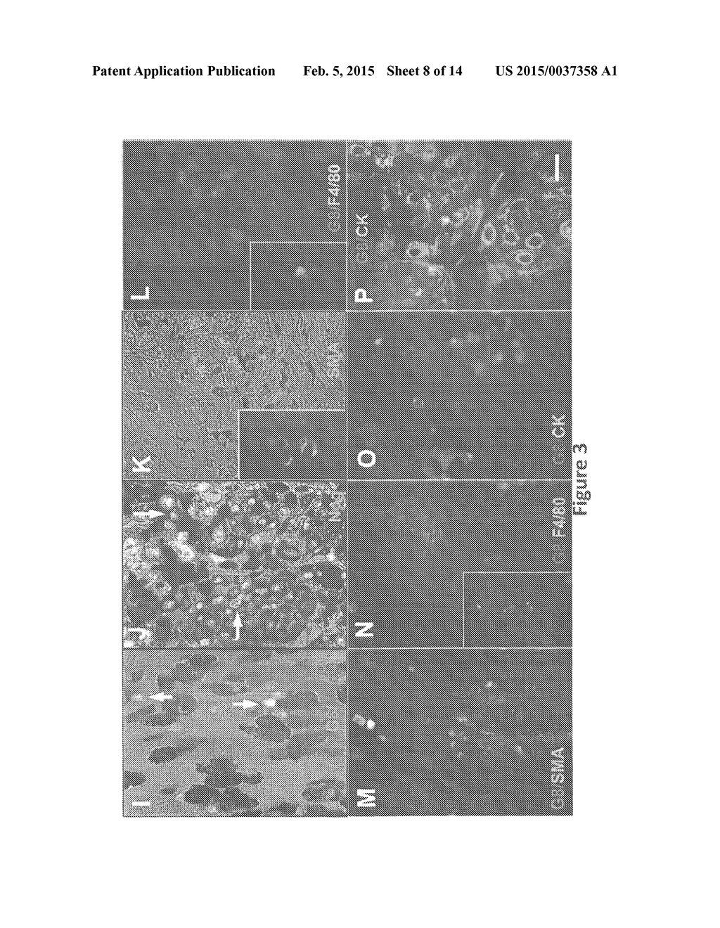 Composition and Methods for Treating Cancer - diagram, schematic, and image 09