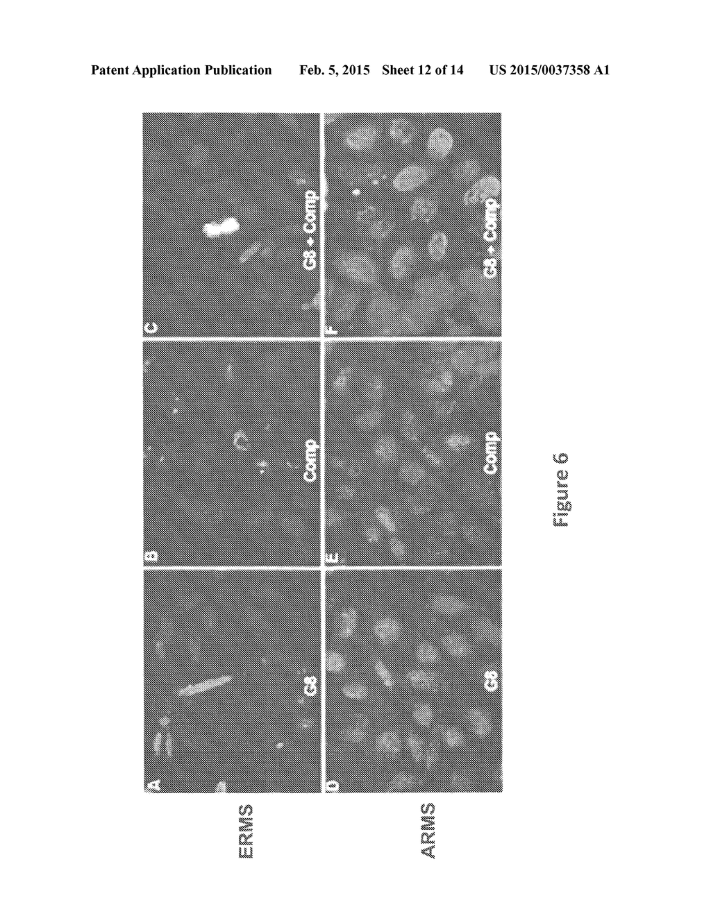 Composition and Methods for Treating Cancer - diagram, schematic, and image 13