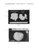 SELF-ASSEMBLY OF COLLAGEN FIBERS FROM DERMIS, FASCIA AND TENDON FOR TISSUE     AUGMENTATION AND COVERAGE OF WOUNDS AND BURNS diagram and image