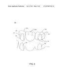 CERAMIC ARTICLES WITH INCREASED SURFACE ROUGHNESS AND METHODS FOR     MANUFACTURING THE SAME diagram and image