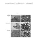 METHODS FOR THE TREATMENT OF SOLID TUMORS diagram and image