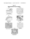 USES OF SELECTIVE INHIBITORS OF HDAC8 AND TREATMENT OF INFLAMMATORY     CONDITIONS diagram and image