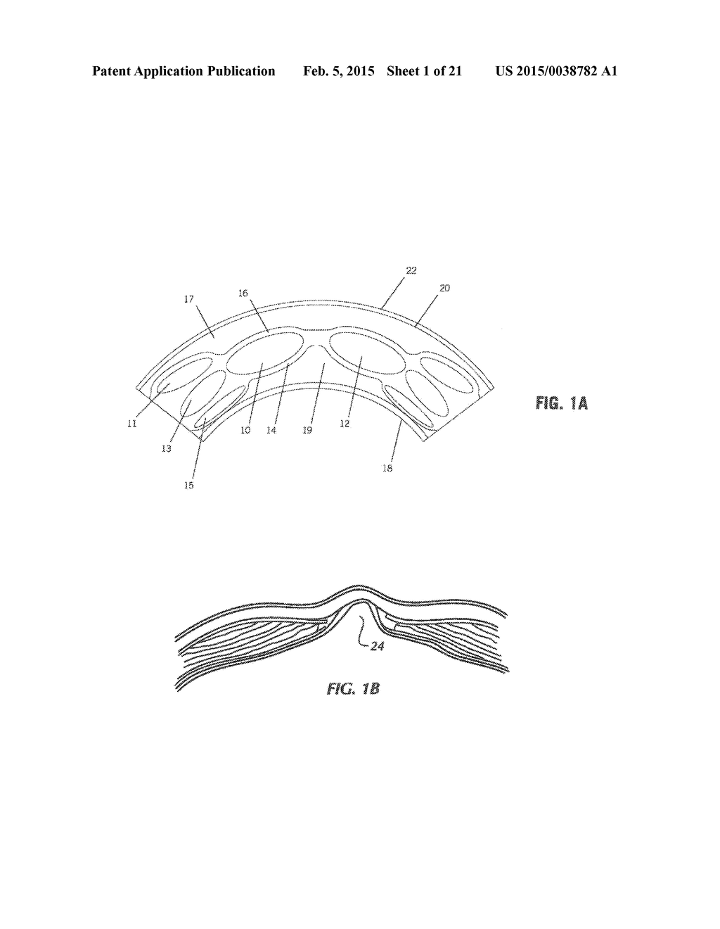 IMPLANT FOR HERNIA REPAIR - diagram, schematic, and image 02