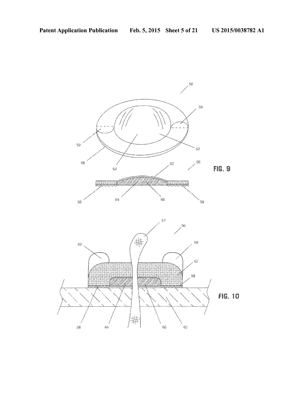 IMPLANT FOR HERNIA REPAIR - diagram, schematic, and image 06