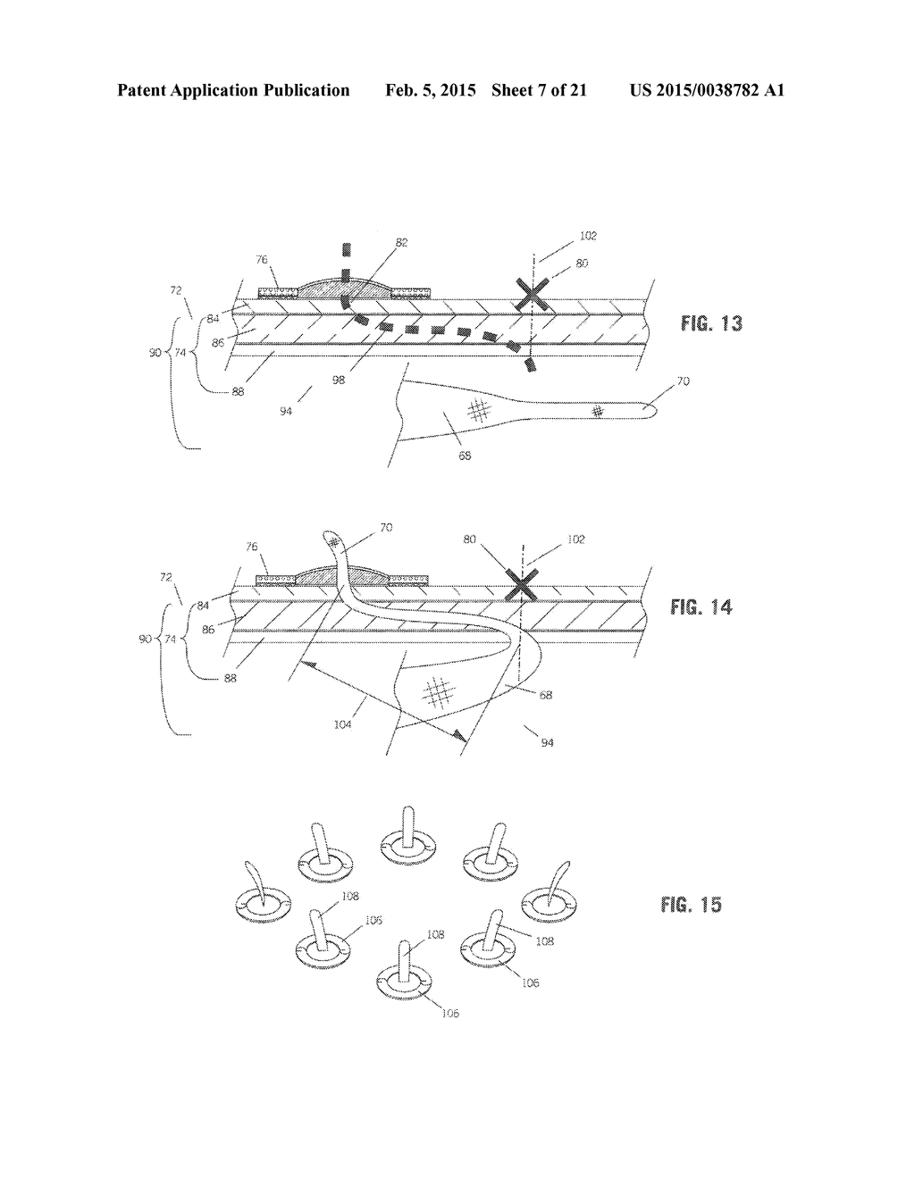 IMPLANT FOR HERNIA REPAIR - diagram, schematic, and image 08