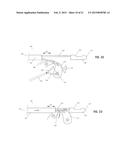 IMPLANT FOR HERNIA REPAIR diagram and image