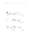 IMPLANT FOR HERNIA REPAIR diagram and image