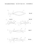 IMPLANT FOR HERNIA REPAIR diagram and image