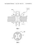 EXPANDING SURGICAL ACCESS PORT diagram and image