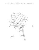 STERILE DRAPE FOR ATTACHMENT TO AN IMAGING MACHINE diagram and image