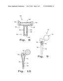 DRUG DELIVERY IMPLANTS diagram and image