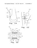 DRUG DELIVERY IMPLANTS diagram and image