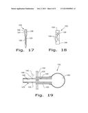 DRUG DELIVERY IMPLANTS diagram and image