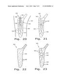 DRUG DELIVERY IMPLANTS diagram and image