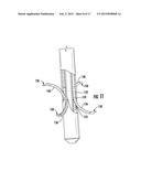 Intramedullary Nail System including Tang-deployment Screw with Male     Interface diagram and image