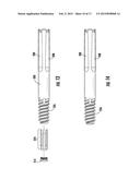 Intramedullary Nail System including Tang-deployment Screw with Male     Interface diagram and image