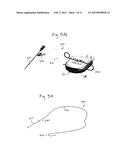 ADAPTER FOR CONNECTION TO PULSE GENERATOR diagram and image