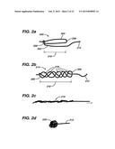 METHODS AND DEVICES FOR REPAIRING AND ANCHORING DAMAGED TISSUE diagram and image