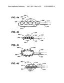 METHODS AND DEVICES FOR REPAIRING AND ANCHORING DAMAGED TISSUE diagram and image