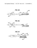 METHODS AND DEVICES FOR REPAIRING AND ANCHORING DAMAGED TISSUE diagram and image