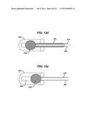 METHODS AND DEVICES FOR REPAIRING AND ANCHORING DAMAGED TISSUE diagram and image