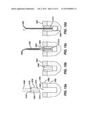 METHODS AND DEVICES FOR REPAIRING AND ANCHORING DAMAGED TISSUE diagram and image