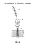 DEVICES, SYSTEMS, AND METHODS FOR PROVIDING SURGICAL ACCESS AND     FACILITATING CLOSURE OF SURGICAL ACCESS OPENINGS diagram and image