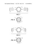 TENDON ANCHOR AND METHOD OF USING SAME diagram and image