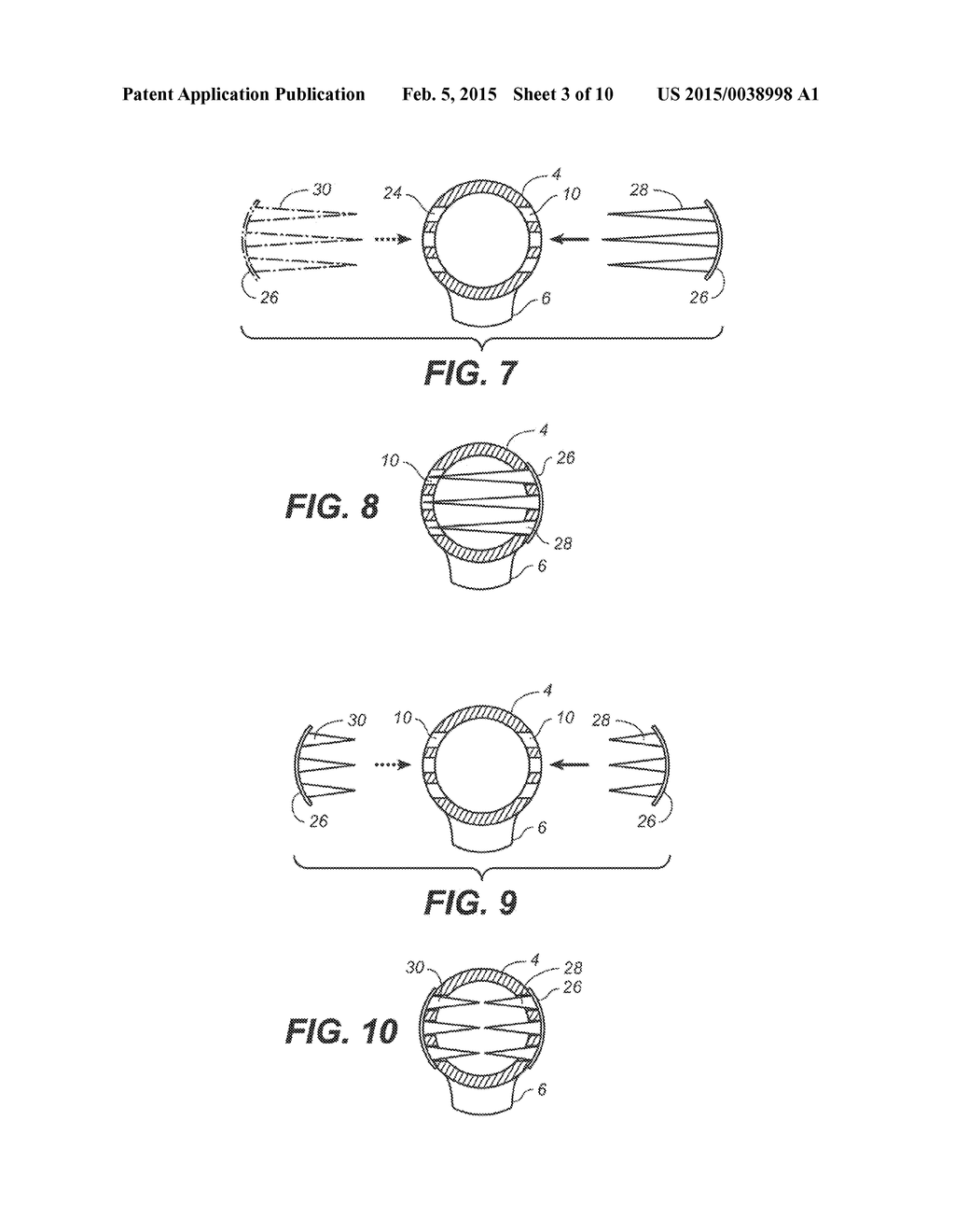 TENDON ANCHOR AND METHOD OF USING SAME - diagram, schematic, and image 04