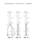 TENDON ANCHOR AND METHOD OF USING SAME diagram and image