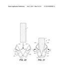 TENDON ANCHOR AND METHOD OF USING SAME diagram and image