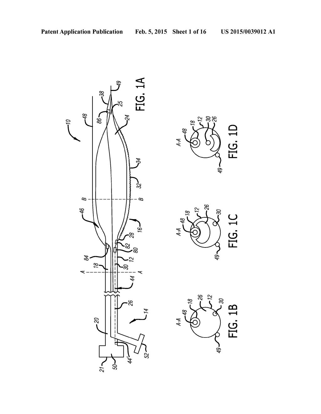 SYSTEMS AND METHODS FOR TREATING A VESSEL USING FOCUSED FORCE - diagram, schematic, and image 02