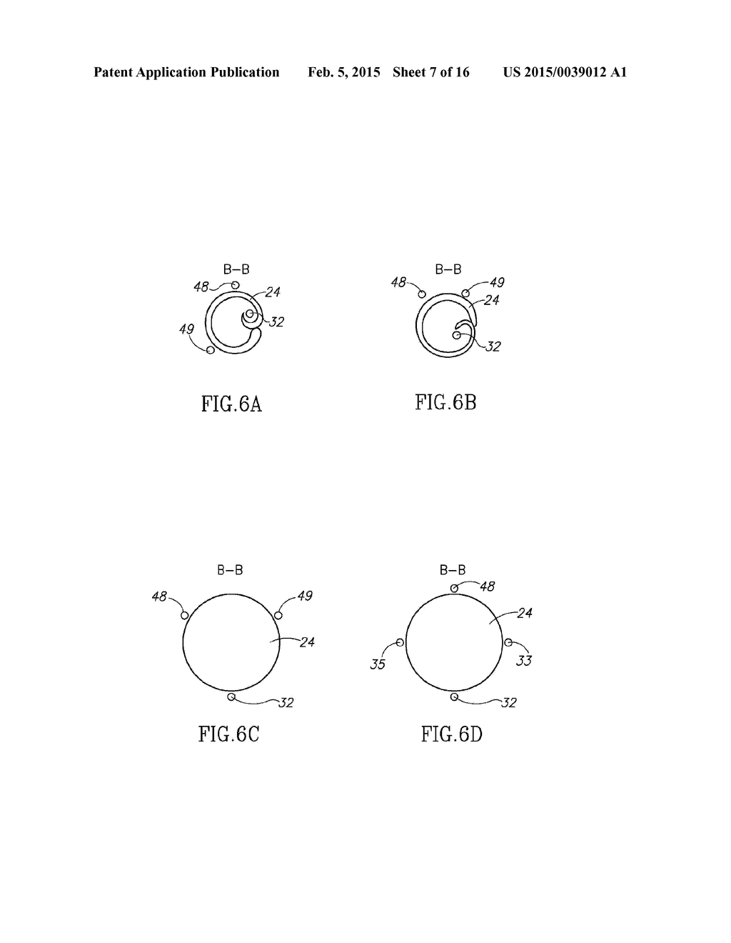 SYSTEMS AND METHODS FOR TREATING A VESSEL USING FOCUSED FORCE - diagram, schematic, and image 08