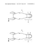 NASAL SUPPORT DEVICE AND METHOD diagram and image