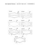 NASAL SUPPORT DEVICE AND METHOD diagram and image