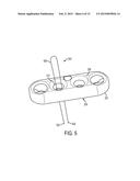 ADJUSTABLE GRAFT FIXATION DEVICE diagram and image