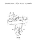 ADJUSTABLE GRAFT FIXATION DEVICE diagram and image